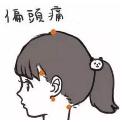 偏頭痛如何調治